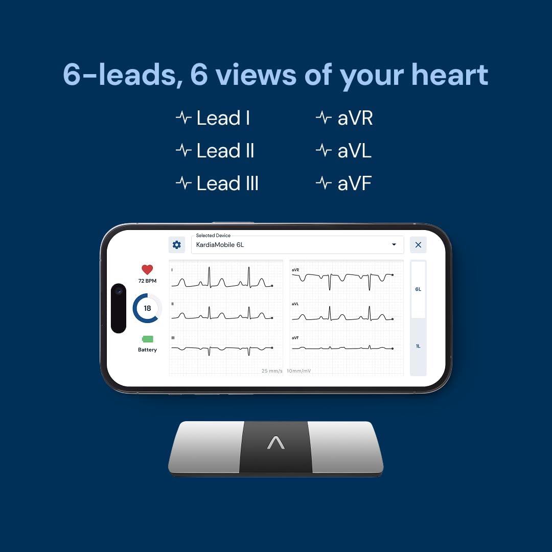AliveCor KardiaMobile 6-Lead Personal EKG Monitor – Six Views of The Heart – Detects AFib and Irregular Arrhythmias – Instant Results in 30 Seconds – Works with Most Smartphones