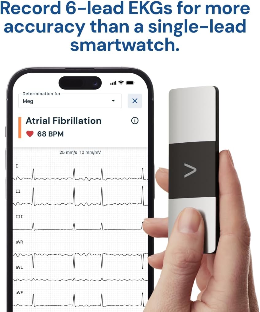 AliveCor KardiaMobile 6-Lead Personal EKG Monitor – Six Views of The Heart – Detects AFib and Irregular Arrhythmias – Instant Results in 30 Seconds – Works with Most Smartphones